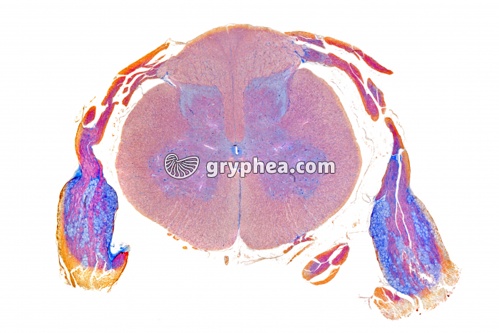 Moëlle épinière avec ganglions CT x2 - gryphea.org